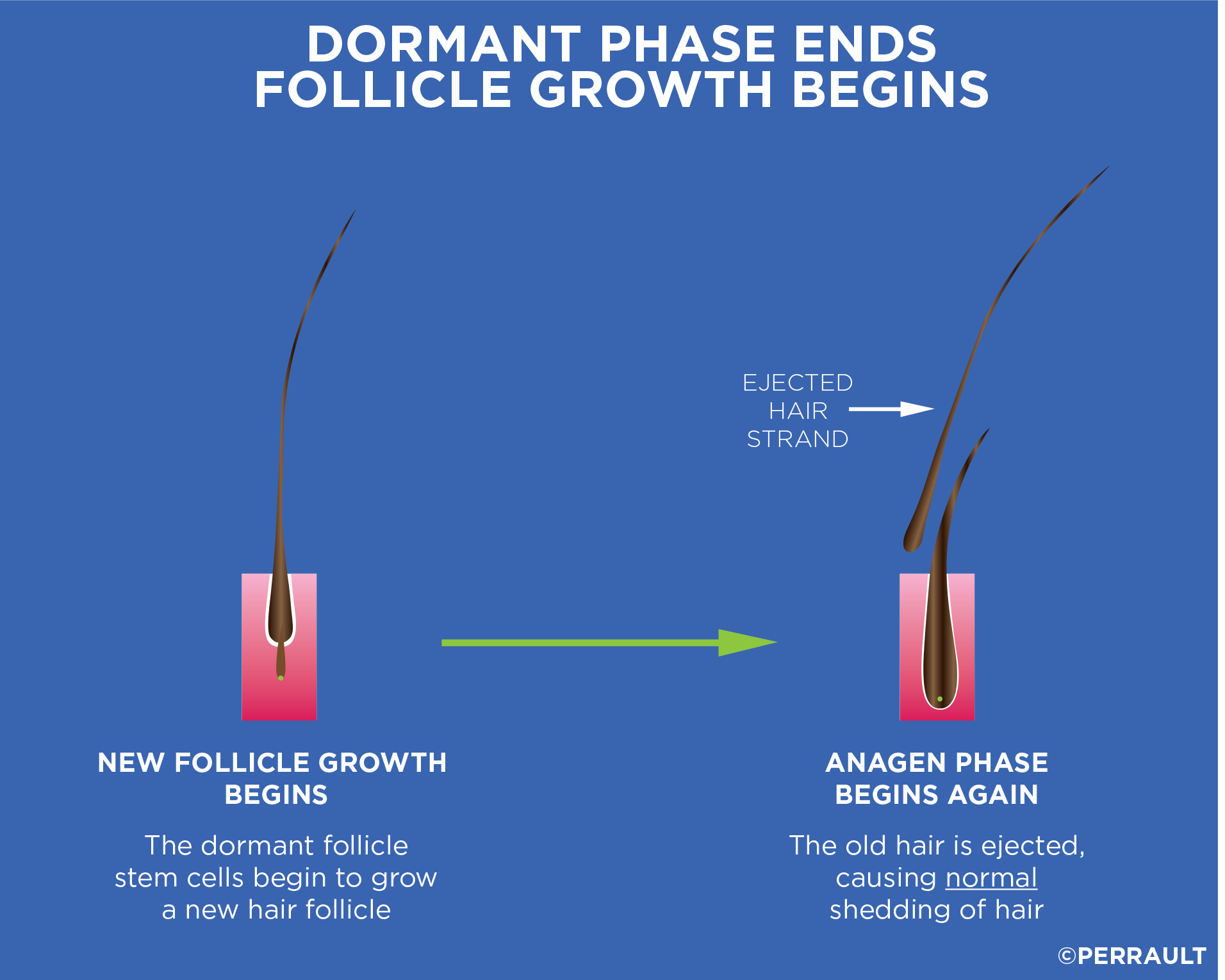 Dormant Phase Ends Follicle Growth Begins
